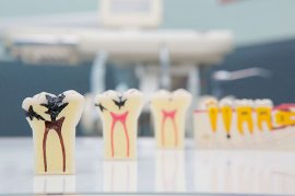 Fallen teeth displayed on table